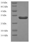 Recombinant Bacillus subtilis Probable flavodoxin-2 (ykuP) – Figure 1 of 1