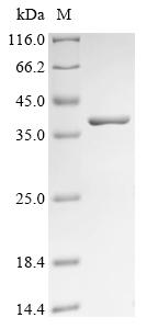 (Tris-Glycine gel) Discontinuous SDS-PAGE (reduced) with 5% enrichment gel and 15% separation gel.