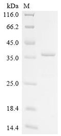 (Tris-Glycine gel) Discontinuous SDS-PAGE (reduced) with 5% enrichment gel and 15% separation gel.