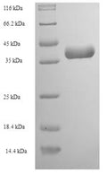 Recombinant Crotalus adamanteus Thrombin-like enzyme crotalase (SVTLE) – Figure 1 of 1
