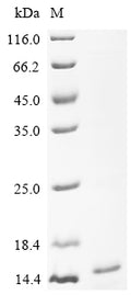 (Tris-Glycine gel) Discontinuous SDS-PAGE (reduced) with 5% enrichment gel and 15% separation gel.
