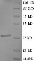 Recombinant Bacillus subtilis Expansin-yoaJ (yoaJ) – Figure 1 of 1