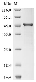 (Tris-Glycine gel) Discontinuous SDS-PAGE (reduced) with 5% enrichment gel and 15% separation gel.