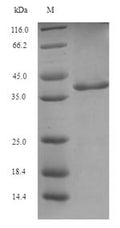 (Tris-Glycine gel) Discontinuous SDS-PAGE (reduced) with 5% enrichment gel and 15% separation gel.
