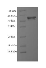 Recombinant Streptomyces achromogenes Modification methylase SacI (sacIM) – Figure 1 of 1