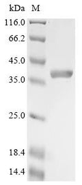 (Tris-Glycine gel) Discontinuous SDS-PAGE (reduced) with 5% enrichment gel and 15% separation gel.