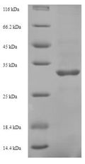 Recombinant Hepatitis B virus genotype D Protein X (X) – Figure 1 of 1