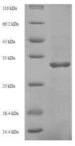 Recombinant Hepatitis B virus genotype D Protein X (X) – Figure 1 of 1