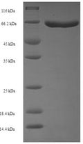 Recombinant Schizosaccharomyces pombe Sulfide:quinone oxidoreductase, mitochondrial (hmt2) – Figure 1 of 1