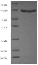 Recombinant Schizosaccharomyces pombe Sulfide:quinone oxidoreductase, mitochondrial (hmt2) – Figure 1 of 1