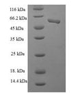 Recombinant Human Casein kinase II subunit alpha' (CSNK2A2), partial – Figure 1 of 1