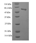 Recombinant Human Casein kinase II subunit alpha' (CSNK2A2), partial – Figure 1 of 1