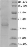 Recombinant Hepatitis E virus genotype 1 Protein ORF3 (ORF3) – Figure 1 of 1