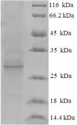 Recombinant Hepatitis E virus genotype 1 Protein ORF3 (ORF3) – Figure 1 of 1