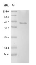 (Tris-Glycine gel) Discontinuous SDS-PAGE (reduced) with 5% enrichment gel and 15% separation gel.