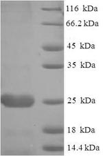 Recombinant Pseudomonas syringae pv. tomato Thiol:disulfide interchange protein DsbA (dsbA) – Figure 1 of 1