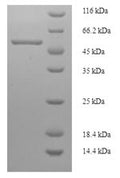 Recombinant Streptomyces caespitosus Modification methylase ScaI (scaIM) – Figure 1 of 1
