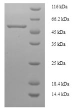 Recombinant Streptomyces caespitosus Modification methylase ScaI (scaIM) – Figure 1 of 1