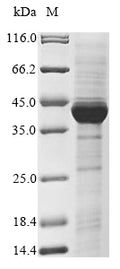 (Tris-Glycine gel) Discontinuous SDS-PAGE (reduced) with 5% enrichment gel and 15% separation gel.