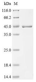 (Tris-Glycine gel) Discontinuous SDS-PAGE (reduced) with 5% enrichment gel and 15% separation gel.