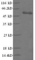 Recombinant Bacillus thuringiensis subsp. Pesticidal crystal protein cry1Fb (cry1Fb), partial – Figure 1 of 1