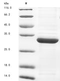 (Tris-Glycine gel) Discontinuous SDS-PAGE (reduced) with 5% enrichment gel and 15% separation gel.