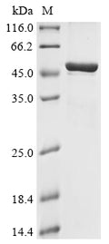 (Tris-Glycine gel) Discontinuous SDS-PAGE (reduced) with 5% enrichment gel and 15% separation gel.