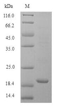 Recombinant Mouse Bis (5'-adenosyl)-triphosphatase (Fhit) – Figure 1 of 1