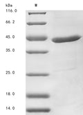 (Tris-Glycine gel) Discontinuous SDS-PAGE (reduced) with 5% enrichment gel and 15% separation gel.