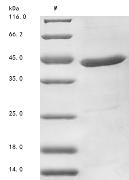 (Tris-Glycine gel) Discontinuous SDS-PAGE (reduced) with 5% enrichment gel and 15% separation gel.