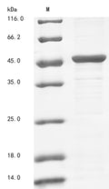 (Tris-Glycine gel) Discontinuous SDS-PAGE (reduced) with 5% enrichment gel and 15% separation gel.