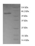 Recombinant Escherichia coli Ribose-5-phosphate isomerase A (rpiA) – Figure 1 of 1