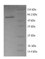 Recombinant Escherichia coli Ribose-5-phosphate isomerase A (rpiA) – Figure 1 of 1