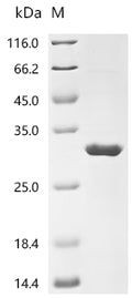 (Tris-Glycine gel) Discontinuous SDS-PAGE (reduced) with 5% enrichment gel and 15% separation gel.