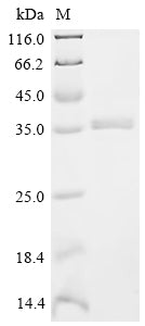 (Tris-Glycine gel) Discontinuous SDS-PAGE (reduced) with 5% enrichment gel and 15% separation gel.