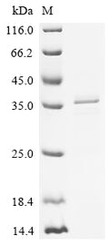 (Tris-Glycine gel) Discontinuous SDS-PAGE (reduced) with 5% enrichment gel and 15% separation gel.