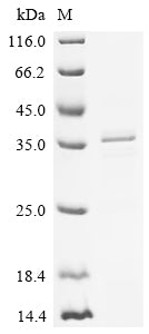 (Tris-Glycine gel) Discontinuous SDS-PAGE (reduced) with 5% enrichment gel and 15% separation gel.