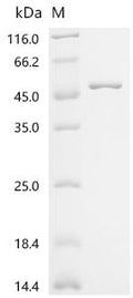 (Tris-Glycine gel) Discontinuous SDS-PAGE (reduced) with 5% enrichment gel and 15% separation gel.