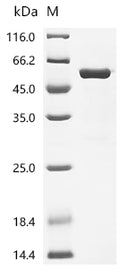 (Tris-Glycine gel) Discontinuous SDS-PAGE (reduced) with 5% enrichment gel and 15% separation gel.