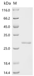 (Tris-Glycine gel) Discontinuous SDS-PAGE (reduced) with 5% enrichment gel and 15% separation gel.