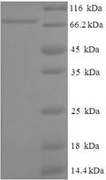 Recombinant Human ATP-dependent RNA helicase A (DHX9), partial – Figure 1 of 1