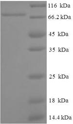 Recombinant Human ATP-dependent RNA helicase A (DHX9), partial – Figure 1 of 1