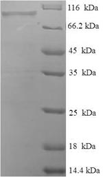 Recombinant Human Peroxisomal bifunctional enzyme (EHHADH) – Figure 1 of 1