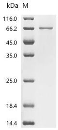 (Tris-Glycine gel) Discontinuous SDS-PAGE (reduced) with 5% enrichment gel and 15% separation gel.