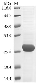 (Tris-Glycine gel) Discontinuous SDS-PAGE (reduced) with 5% enrichment gel and 15% separation gel.