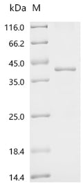 (Tris-Glycine gel) Discontinuous SDS-PAGE (reduced) with 5% enrichment gel and 15% separation gel.