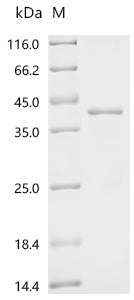(Tris-Glycine gel) Discontinuous SDS-PAGE (reduced) with 5% enrichment gel and 15% separation gel.