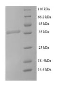Recombinant Mycobacterium tuberculosis Signal peptidase I (lepB), partial – Figure 1 of 1
