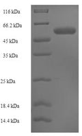 Recombinant Human CMP-N-acetylneuraminate-beta-1,4-galactoside alpha-2,3-sialyltransferase (ST3GAL3), partial – Figure 1 of 1