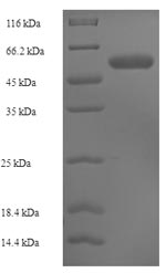 Recombinant Human CMP-N-acetylneuraminate-beta-1,4-galactoside alpha-2,3-sialyltransferase (ST3GAL3), partial – Figure 1 of 1